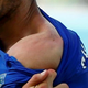Illustration for article titled Luis Suárez Just Bit Someone Again!